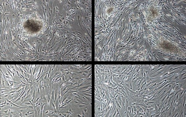 피부 세포 변화과정  (사진= Babraham Institute/PA Wire)