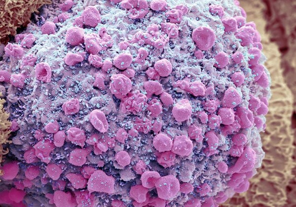 죽어가는 장 세포에서 SARS-CoV-2 바이러스가 발견되었다./ 파란색부분. (사진=스티브 그슈마이스너 / SP)