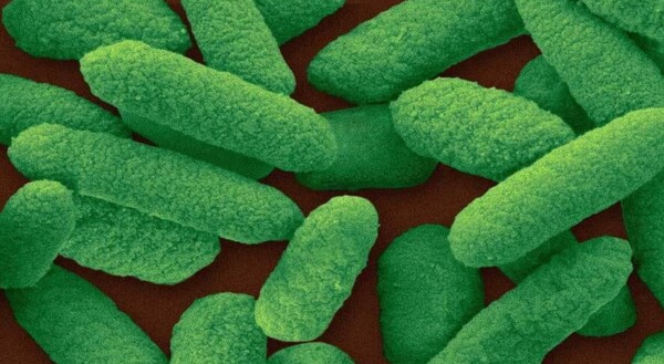 크로노박터 사카자키(Cronobacter sakazakii)의  전자 현미경(SEM) 으로 본 모습. (사진=PHOTOGRAPH BY DENNIS KUNKEL MICROSCOPY, SCIENCE SOURCE）