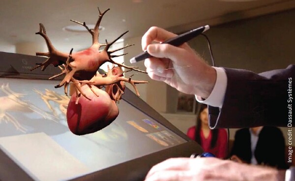 다쏘시스템은 치료하기 어려운 심장 상태를 가진 어린이에게 도움이 될 수 있는 장치를 테스트하고 있다..(사진=Dassault Systemes)