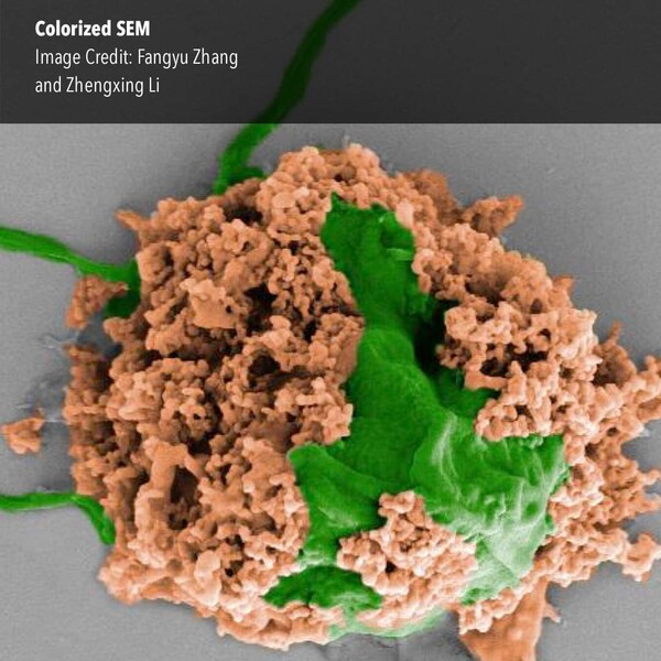 생분해성 고분자 나노입자(갈색)로 덮인 조류 세포(녹색)로 만든 폐렴 퇴치 마이크로 로봇이 폐렴과 싸우는 모습. (사진=Fangyu Zhang and Zhengxing)