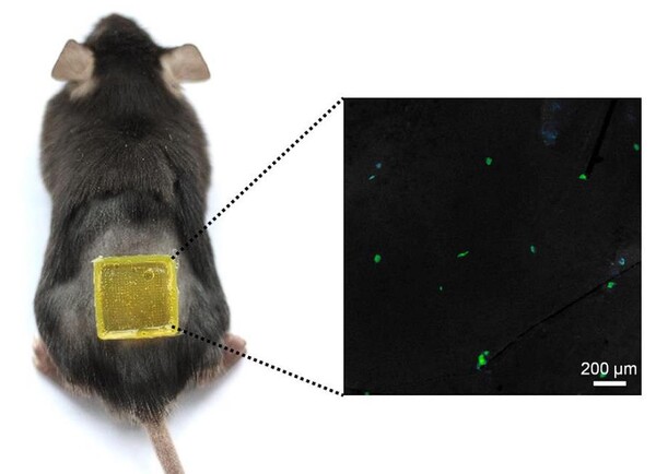 연구원들은 작은 미세 바늘 패치를 사용하여, 탈모증에 걸린 쥐를 치료하기 시작했다.(사진=Nano Letters)