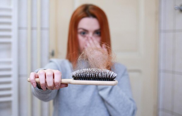 탈모는 유전 및 남성 호르몬이 원인이므로 근본적인 예방법은 없다. 다만 스트레스를 줄이고 규칙적인 생활과 균형 잡힌 영양 섭취가 탈모 치료에 도움이 될 수 있다.(사진=pixabay)