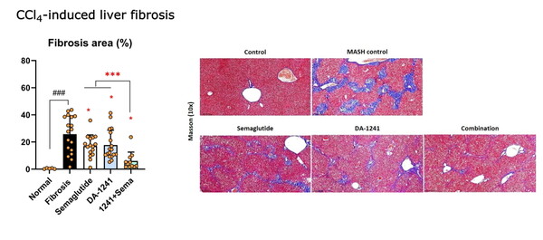EASL 2024 DA-1241, 세마글루타이드 단독연구 결과: DA-1241은 체중 감소를 유도하지 않았음에도 유의적으로 간 섬유화를 개선시켰으며, 체중감소를 유도하는 세마글루타이드와 병용 시에는 추가적인 체중변화는 없이, 각 약물의 단독 대비 통계적으로 유의한 섬유화 개선 병용효과를 나타냄.